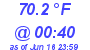 Milwaukee Weather Dewpoint High High Today