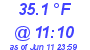 Milwaukee Weather Dewpoint High Low Today