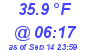 Milwaukee Weather Dewpoint High Low Today